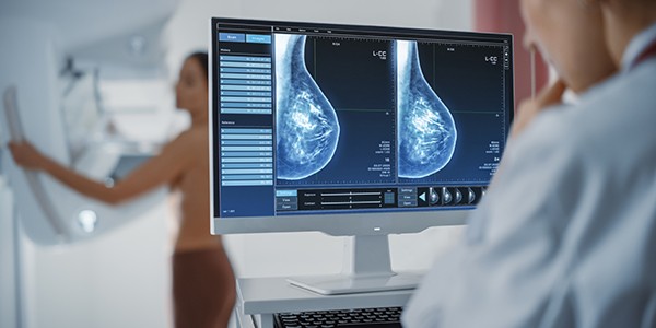 Breast Cancer Breast Cancer